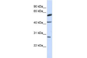 WB Suggested Anti-RNF170 Antibody Titration:  0. (RNF170 anticorps  (Middle Region))