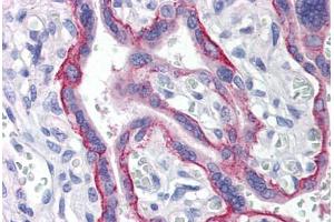 Human Placenta (formalin-fixed, paraffin-embedded) stained with LRRC1 antibody ABIN214508 at 5 ug/ml followed by biotinylated goat anti-rabbit IgG secondary antibody ABIN481713, alkaline phosphatase-streptavidin and chromogen. (LRRC1 anticorps  (C-Term))