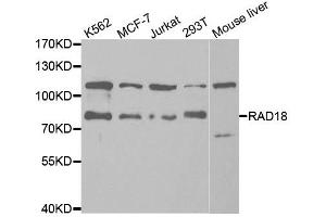 Western Blotting (WB) image for anti-E3 ubiquitin-protein ligase RAD18 (RAD18) antibody (ABIN1876568) (RAD18 anticorps)