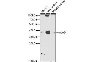 Western blot analysis of extracts of various cell lines, using ALAD antibody (ABIN6129891, ABIN6136749, ABIN6136751 and ABIN6216012) at 1:1000 dilution. (ALAD anticorps  (AA 1-330))