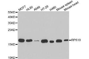 Western blot analysis of extracts of various cell lines, using RPS10 antibody. (RPS10 anticorps  (AA 1-165))
