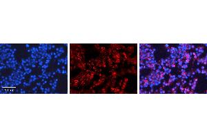 Rabbit Anti-PML Antibody   Formalin Fixed Paraffin Embedded Tissue: Human Bone Marrow Tissue Observed Staining: Nucleus, Cytoplasm Primary Antibody Concentration: 1:100 Other Working Concentrations: 1:600 Secondary Antibody: Donkey anti-Rabbit-Cy3 Secondary Antibody Concentration: 1:200 Magnification: 20X Exposure Time: 0.