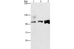 Western Blot analysis of A431, 293T and hela cell using ASCC2 Polyclonal Antibody at dilution of 1:500 (ASCC2 anticorps)