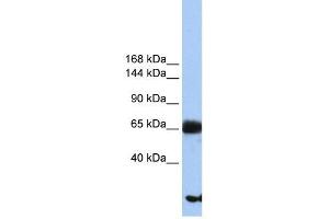 PIGO antibody used at 1 ug/ml to detect target protein. (IGLL1 anticorps  (N-Term))