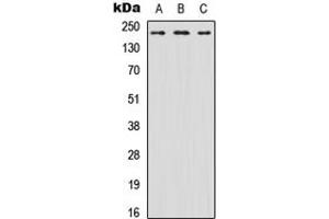 Western blot analysis of Nav1.