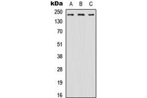 Western blot analysis of Nav1. (SCN8A anticorps  (N-Term))