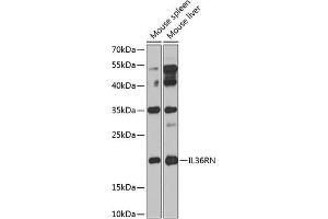 Western blot analysis of extracts of various cell lines, using IL36RN antibody (ABIN6132859, ABIN6142394, ABIN6142395 and ABIN6224229) at 1:1000 dilution.