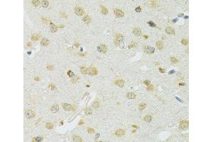 Immunohistochemistry of paraffin-embedded Mouse brain using SLC37A4 Polyclonal Antibody at dilution of 1:100 (40x lens).