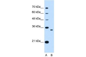 WB Suggested Anti-NDRG2 Antibody Titration:  0. (NDRG2 anticorps  (C-Term))