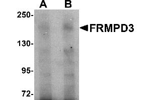 Western Blotting (WB) image for anti-FERM and PDZ Domain Containing 3 (FRMPD3) (Middle Region) antibody (ABIN1030934) (FRMPD3 anticorps  (Middle Region))