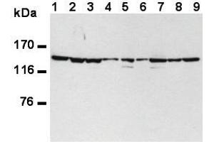 Western Blotting (WB) image for anti-Splicing Factor 3b, Subunit 1, 155kDa (SF3B1) (AA 98-198) antibody (ABIN1449241) (SF3B1 anticorps  (AA 98-198))
