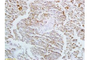 Formalin-fixed and paraffin embedded rat lung labeled with Anti-Claudin-4 Polyclonal Antibody, Unconjugated  at 1:200 followed by conjugation to the secondary antibody and DAB staining
