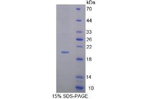 SDS-PAGE of Protein Standard from the Kit (Highly purified E.