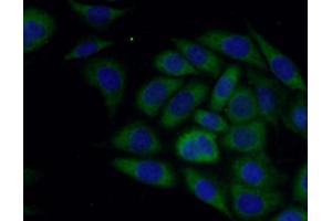 IF analysis of PC-3 cells, using SLN antibody (1/50 dilution) and AF488-conjugated Goat anti-Rabbit IgG (H+L). (SLN anticorps)