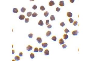 Immunocytochemistry of TRAF6 in K562 cells with this product at 0.