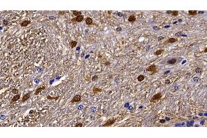 Detection of S100B in Mouse Cerebellum Tissue using Polyclonal Antibody to S100 Calcium Binding Protein B (S100B)