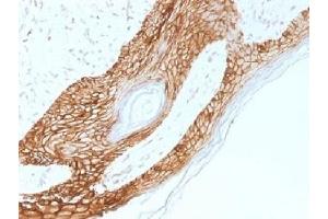 IHC testing of FFPE human skin with E-Cadherin antibody (clone 4A2).