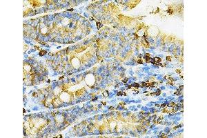 Immunohistochemistry of paraffin-embedded Mouse intestine using HGF Polyclonal Antibody at dilution of 1:100 (40x lens).