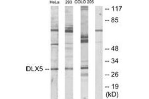 Western blot analysis of extracts from HeLa/293/COLO205 cells, using DLX5 Antibody. (DLX5 anticorps  (AA 91-140))