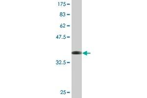 Western Blot detection against Immunogen (36. (CHRAC1 anticorps  (AA 1-96))