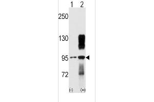 Western blot analysis of TYRO10 using rabbit polyclonal TYRO10 Antibody using 293 cell lysates (2 ug/lane) either nontransfected (Lane 1) or transiently transfected with the DDR2 gene (Lane 2). (DDR2 anticorps)