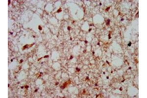 IHC image of ABIN7155717 diluted at 1:800 and staining in paraffin-embedded human brain tissue performed on a Leica BondTM system.
