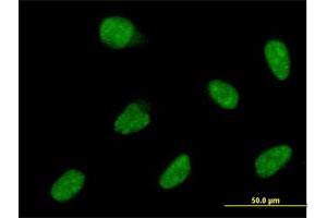 Immunofluorescence of monoclonal antibody to ATOH1 on HeLa cell. (ATOH1 anticorps  (AA 266-354))