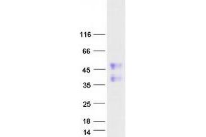 Validation with Western Blot