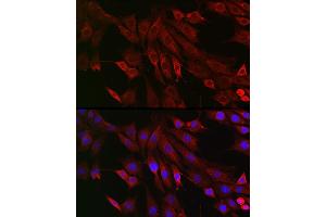 Immunofluorescence analysis of U2OS cells using RMDN3 Rabbit pAb (ABIN6127274, ABIN6146979, ABIN6146981 and ABIN6221512) at dilution of 1:250 (40x lens). (RMDN3 anticorps  (AA 171-470))