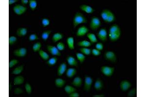Immunofluorescence staining of Hela cells with ABIN7150781 at 1:66, counter-stained with DAPI.