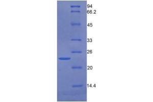 SDS-PAGE of Protein Standard from the Kit (Highly purified E. (GAS6 Kit ELISA)