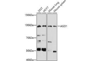 Western blot analysis of extracts of various cell lines, using (ABIN6129376, ABIN6136636, ABIN6136637 and ABIN6221667) at 1:1000 dilution. (AGO1 anticorps  (AA 1-180))