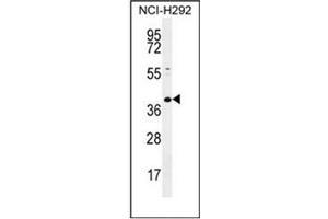 Western blot analysis of KCTD2 Antibody (C-term) in NCI-H292 cell line lysates (35ug/lane). (KCTD2 anticorps  (C-Term))