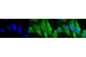 Immunocytochemistry/Immunofluorescence analysis using Mouse Anti-HO-1 Monoclonal Antibody, Clone 1F12-A6 (ABIN361696 and ABIN361697).