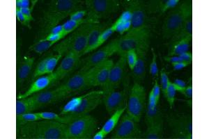 Immunofluorescent staining of SK-N-SH cells (Human neuroblastoma, ATCC HTB-11) (right). (Dynactin 1 anticorps  (AA 3-202))