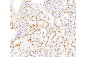 Immunohistochemistry (IHC) image for anti-Small Nuclear Ribonucleoprotein Polypeptide A (SNRPA) (AA 205-255) antibody (ABIN7453449) (SNRPA1 anticorps  (AA 205-255))