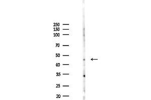anti-Porcupine Homolog (PORCN) antibody