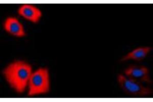 Immunofluorescent analysis of Caspase 1 p10 staining in HeLa cells. (Caspase 1 (p10) anticorps  (C-Term))