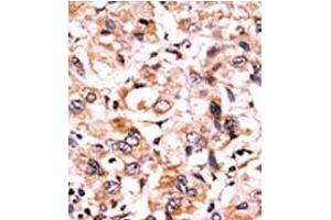 Image no. 1 for anti-WEE1 Homolog (S. Pombe) (WEE1) (pSer123) antibody (ABIN358251)