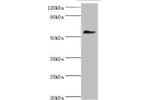 Western blot All lanes: T-complex protein 1 subunit gamma antibody at 12 μg/mL + Mouse brain tissue Secondary Goat polyclonal to rabbit IgG at 1/10000 dilution Predicted band size: 61, 57 kDa Observed band size: 61 kDa (CCT3 anticorps  (AA 1-300))