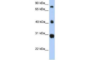 FIBCD1 antibody used at 1 ug/ml to detect target protein.