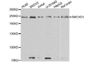 Western blot analysis of extracts of various cell lines, using SMCHD1 antibody. (SMCHD1 anticorps  (AA 1756-2005))