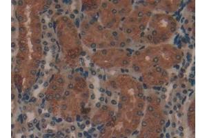 Detection of COL1a1 in Mouse Kidney Tissue using Polyclonal Antibody to Collagen Type I Alpha 1 (COL1a1)