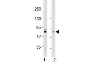 Western blot testing of DYRK1A antibody at 1:2000 dilution.