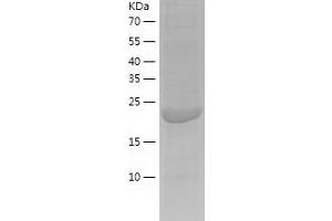 Western Blotting (WB) image for Calcyphosine-Like (CAPSL) (AA 1-208) protein (His-IF2DI Tag) (ABIN7122097)