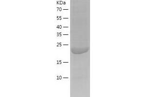 Western Blotting (WB) image for Calcyphosine-Like (CAPSL) (AA 1-208) protein (His tag) (ABIN7122097)