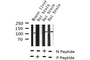 Western blot analysis of Phospho-Retinoblastoma (Ser780) expression in various lysates (Retinoblastoma 1 anticorps  (pSer780))