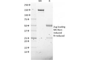 SDS-PAGE Analysis Purified NKX2.