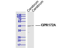 Lane 1: Cerebrum lysates Lane 2: Cerebrum lysates probed with GPR172A Polyclonal Antibody, Unconjugated  at 1:300 dilution and 4˚C overnight incubation. (GPR172A anticorps  (AA 101-200))