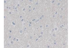Detection of CUL9 in Human Cerebrum Tissue using Polyclonal Antibody to Cullin 9 (CUL9)